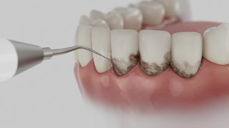 Reliable Dental contractor in Breckenridge, CO by Dentist Open Now